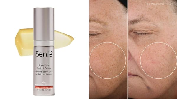 Senté Even Tone Retinol Cream Review: The Secret to Brighter, More Even Skin